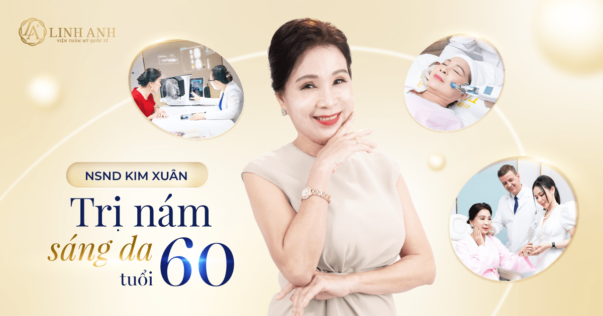 Nghệ sĩ Kim Xuân tin tưởng chọn Thẩm Mỹ Linh Anh là nơi nâng cấp nhan sắc