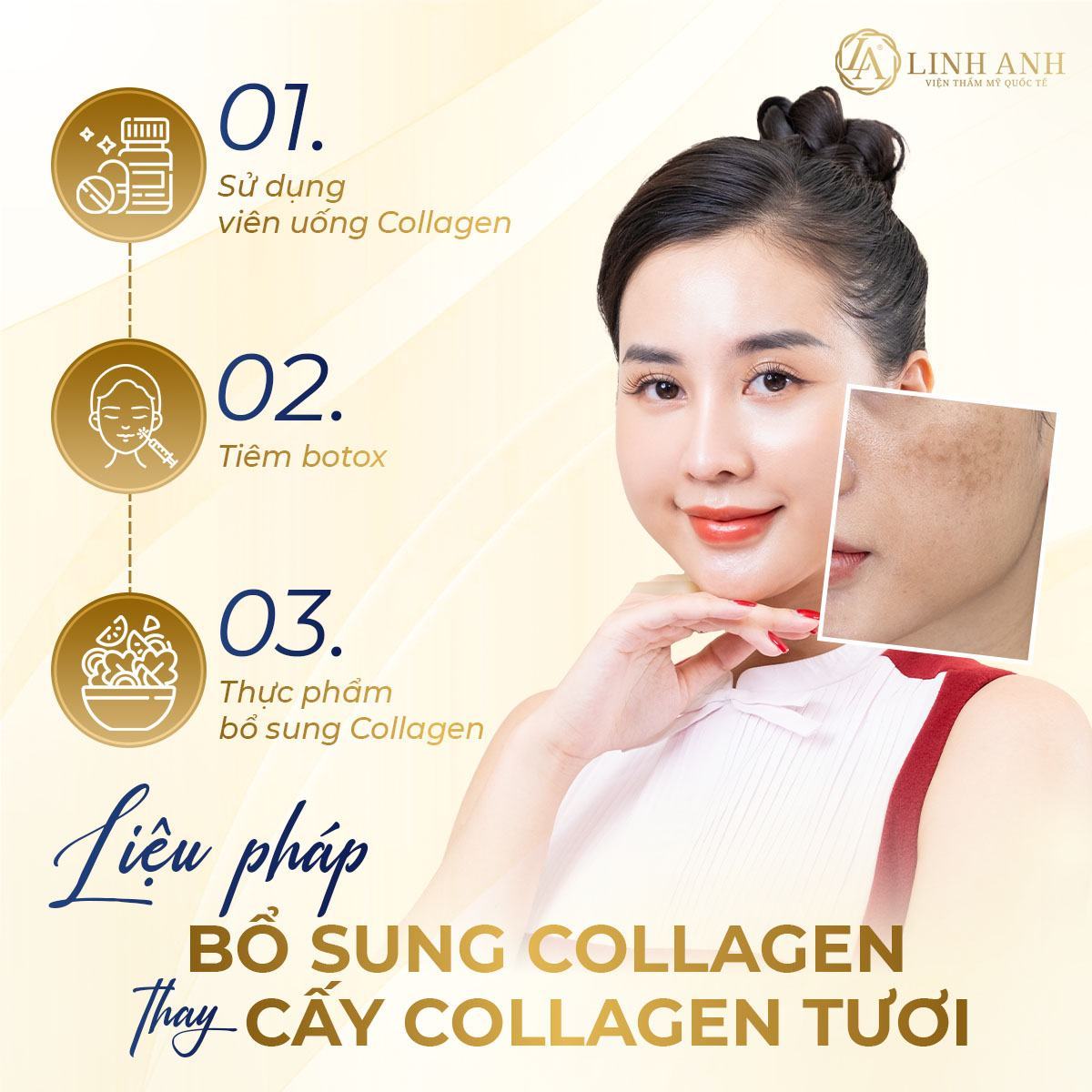 quy trình cấy collagen tươi - Viện thẩm mỹ quốc tế Linh Anh