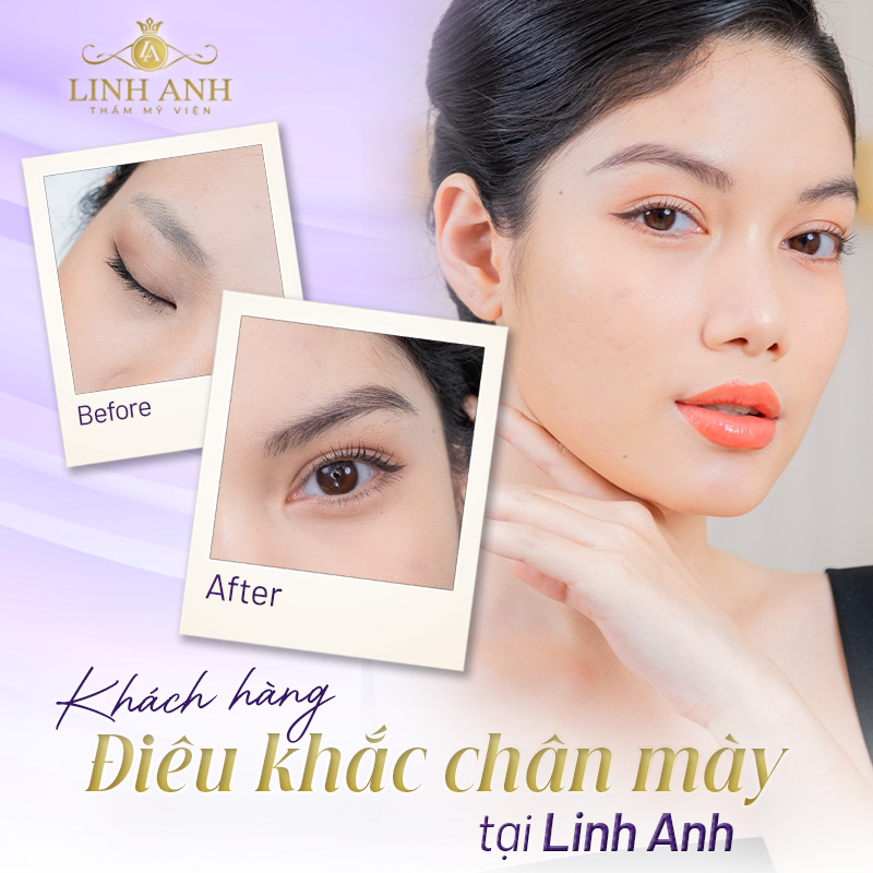 Hậu quả điêu khắc lông mày lỗi