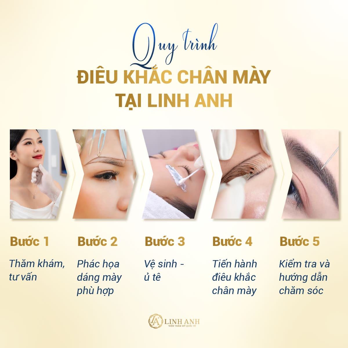 dịch vụ điêu khắc lông mày - Viện thẩm mỹ quốc tế Linh Anh