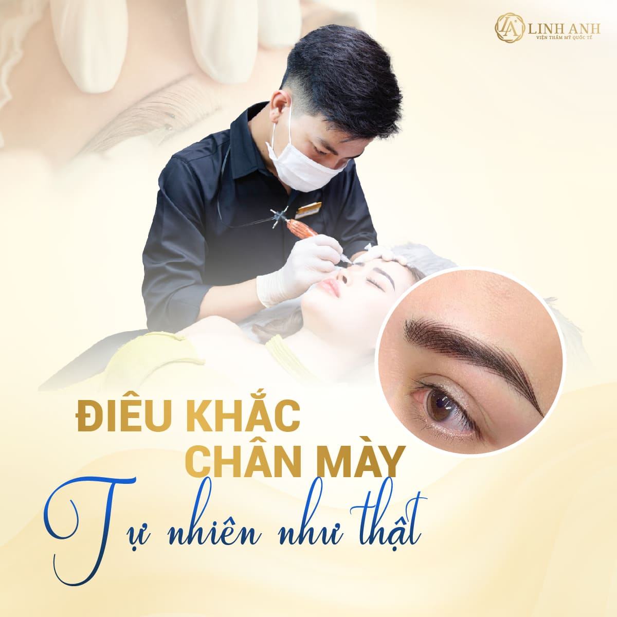 điêu khắc chân mày là gì - Viện thẩm mỹ quốc tế Linh Anh