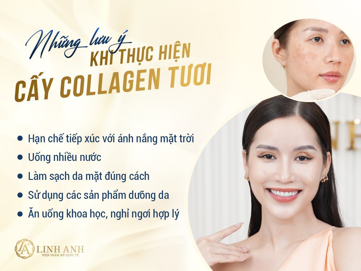 chi phí cấy collagen tươi - Viện thẩm mỹ quốc tế Linh Anh