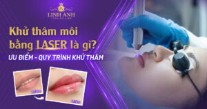 khử thâm môi bằng laser