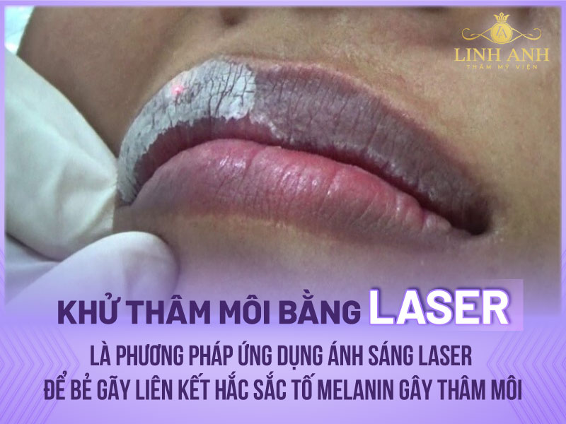 khử thâm môi laser