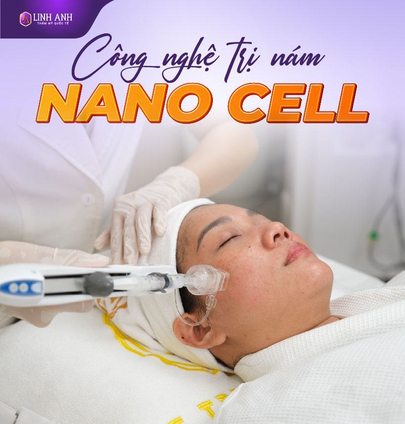 công nghệ trị nám chân sâu bằng nano cell