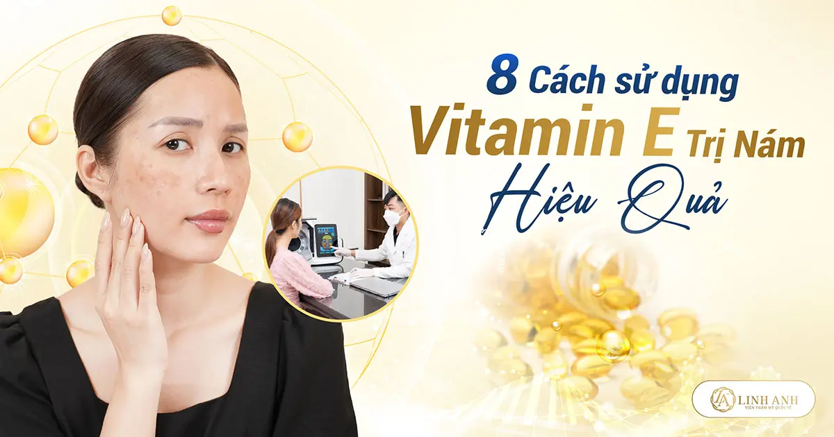 trị nám bằng vitamin e - Viện thẩm mỹ quốc tế Linh Anh