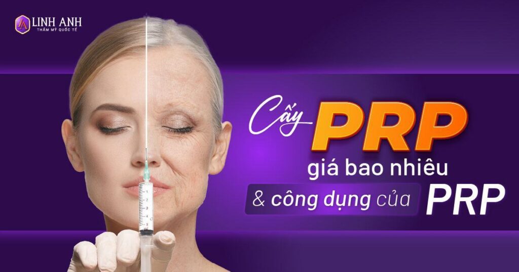 cấy prp giá bao nhiêu - Viện thẩm mỹ quốc tế Linh Anh