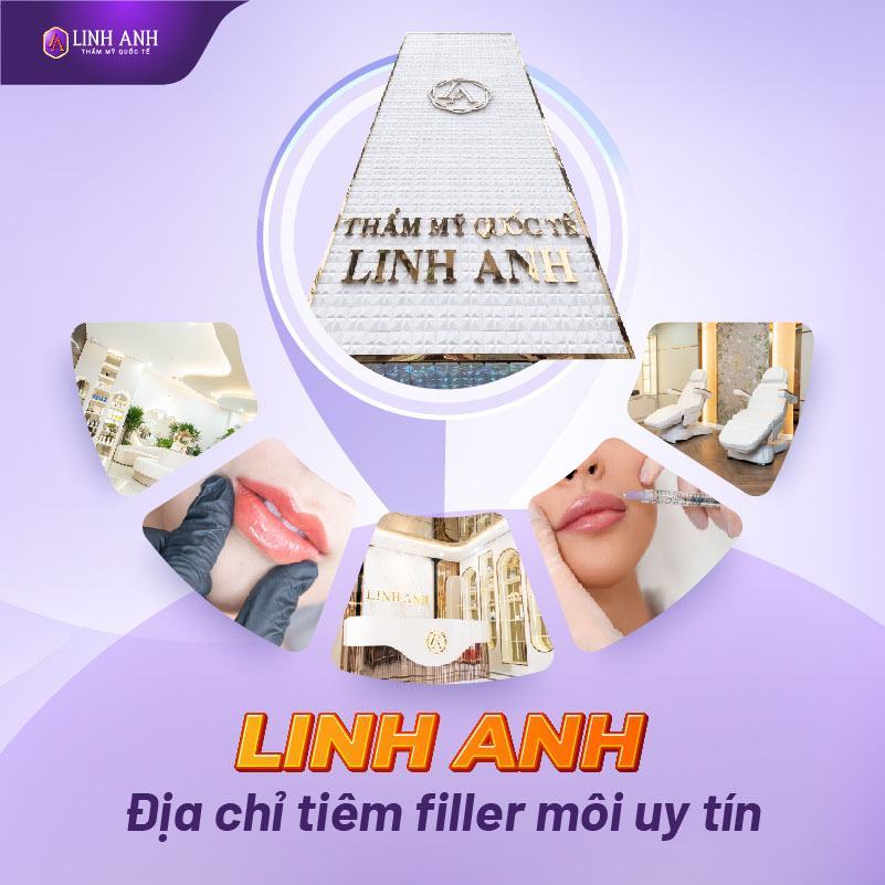 chi phí tiêm filler môi - Viện thẩm mỹ quốc tế Linh Anh chi phí tiêm filler môi - Viện thẩm mỹ quốc tế Linh Anh