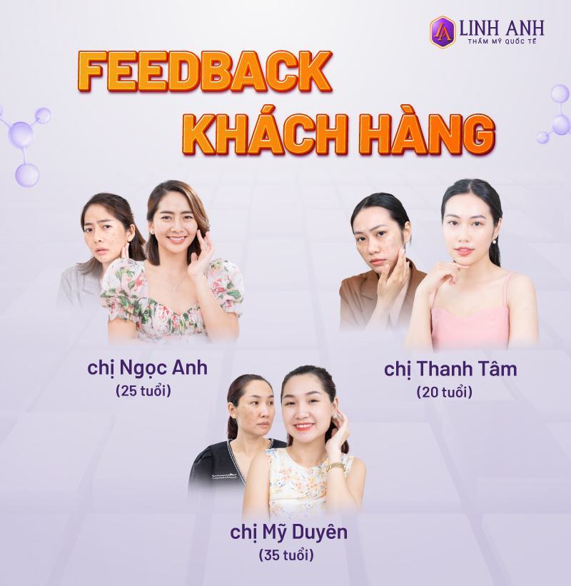 có nên lăn kim trị nám không