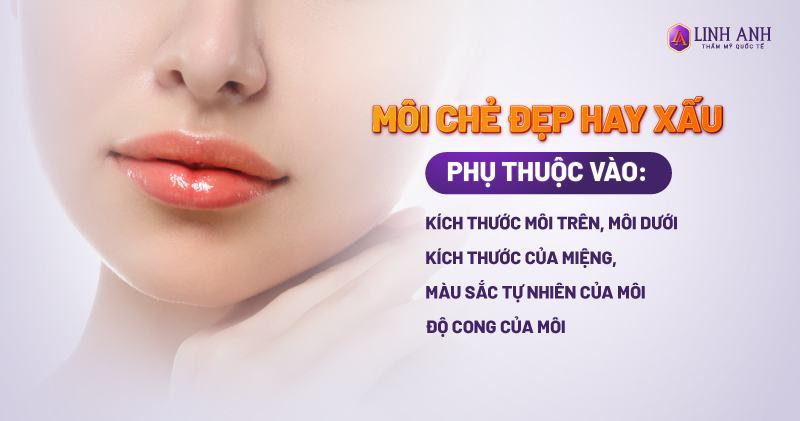 Môi chẻ