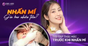 nhấn mí bao nhiêu tiền - Viện thẩm mỹ quốc tế Linh Anh