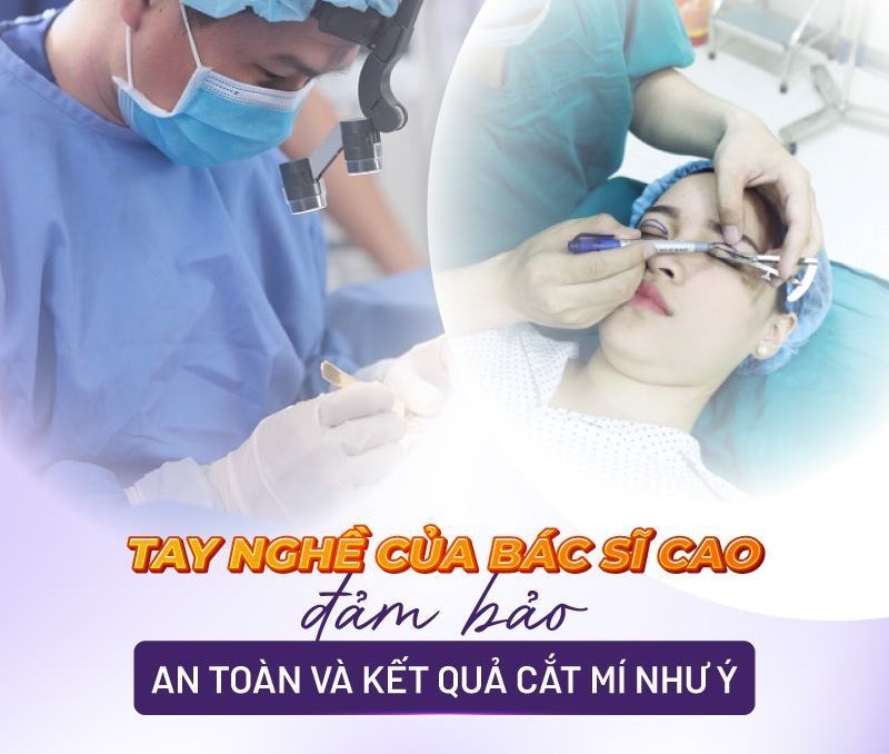 cắt mí mắt giá bao nhiêu cắt mí mắt giá bao nhiêu