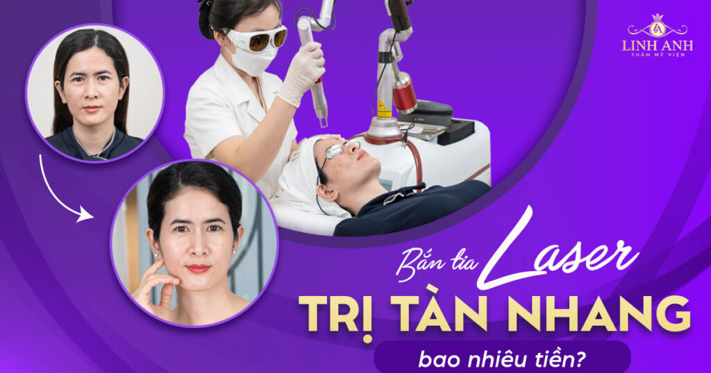 bắn tia laser trị tàn nhang bao nhiêu tiền