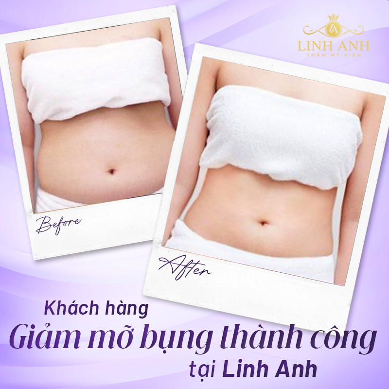 các phương pháp giảm mỡ bụng