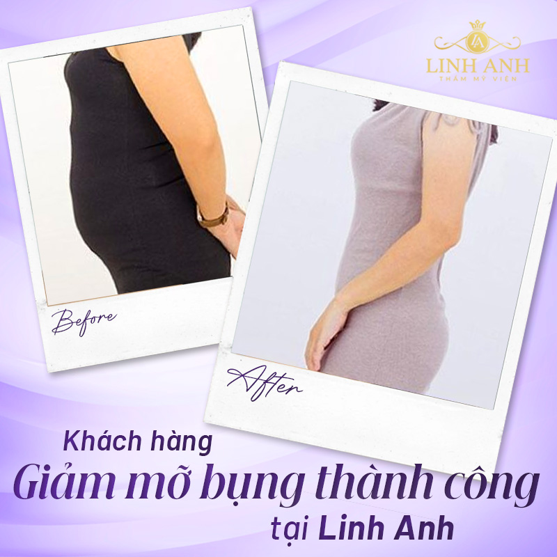 cách giảm béo bụng hiệu quả
