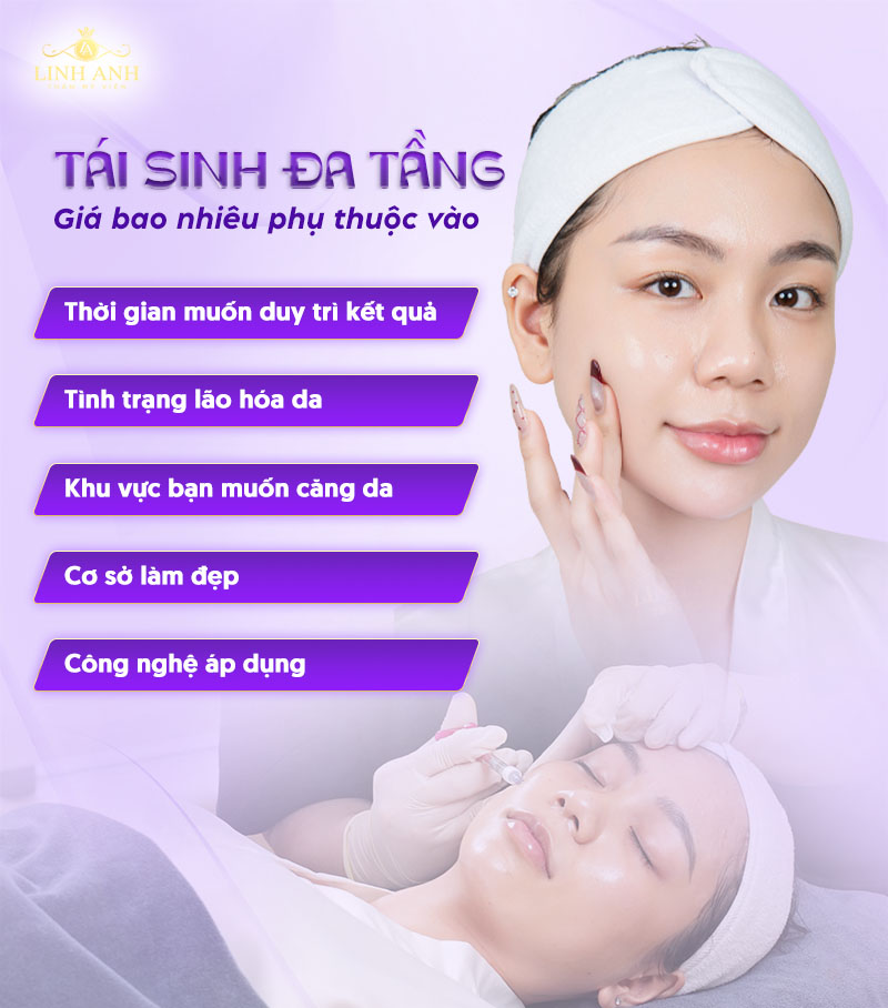 chi phí tái sinh đa Tầng