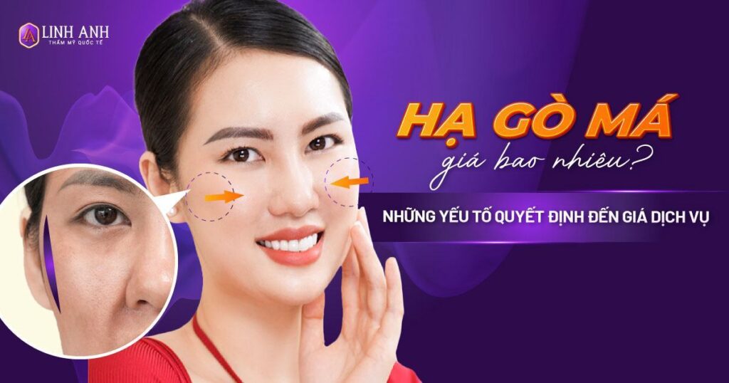 hạ gò má giá bao nhiêu - Viện thẩm mỹ quốc tế Linh Anh