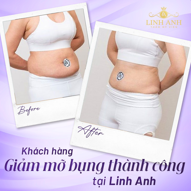 làm sao giảm mỡ bụng