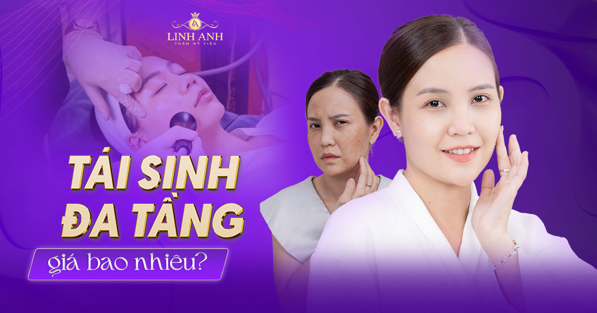 Trẻ hóa da bằng công nghệ tái sinh đa tầng giá bao nhiêu tiền?