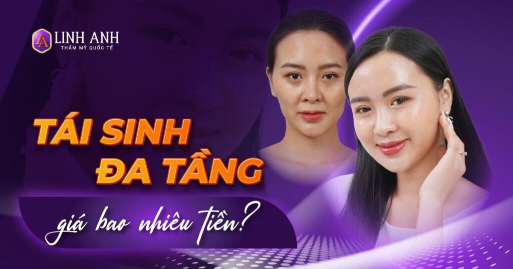 tái sinh đa tầng giá bao nhiêu tiền - Viện thẩm mỹ quốc tế Linh Anh