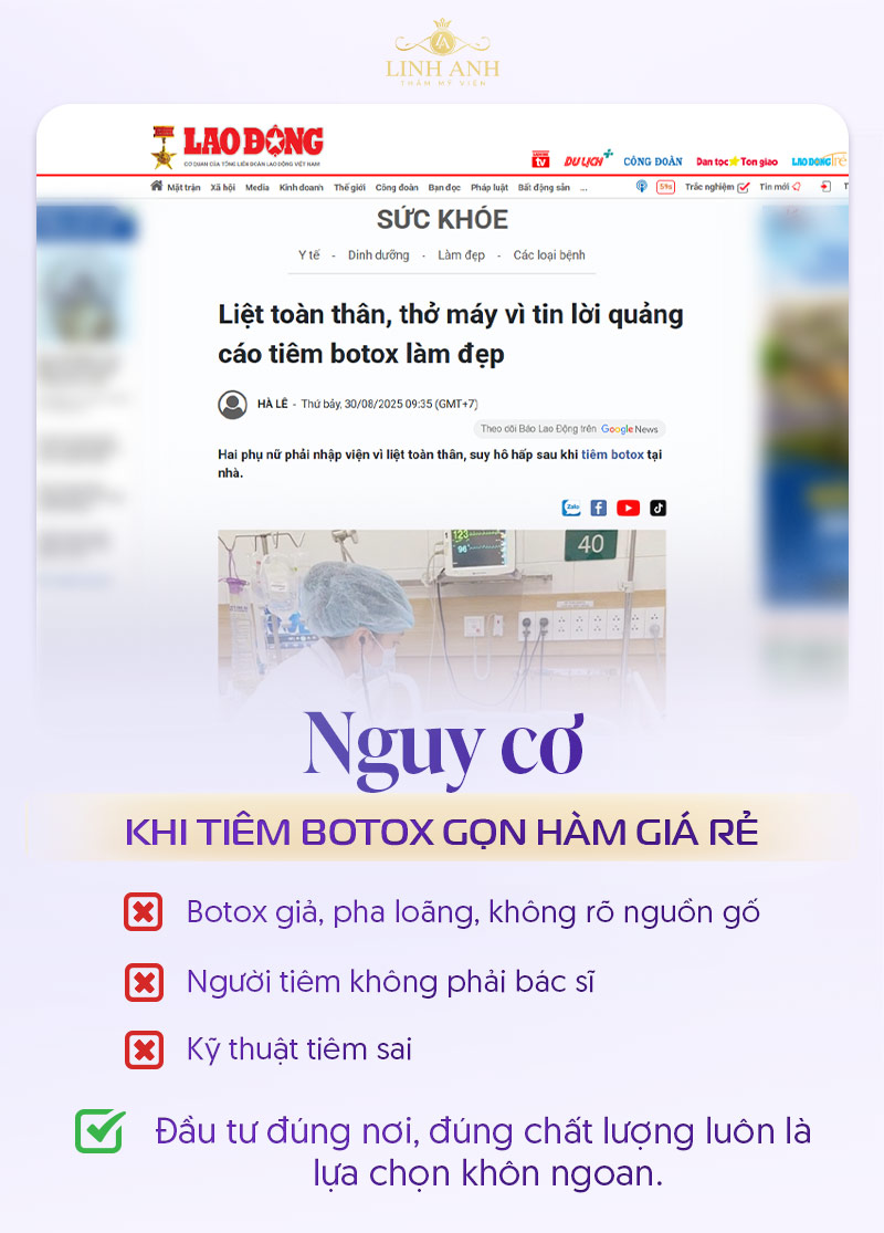 Tiêm botox gọn hàm giá rẻ