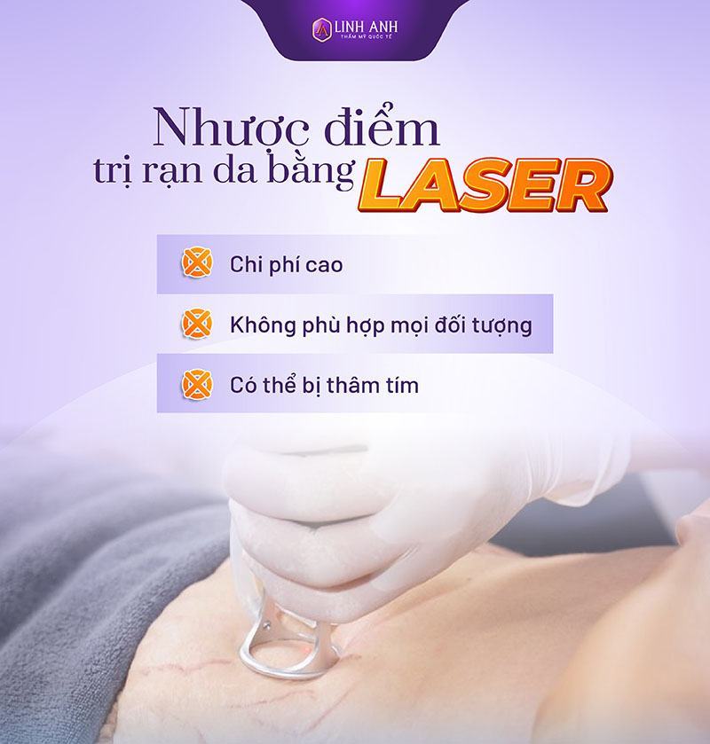 trị rạn da bằng laser bao nhiêu - Viện thẩm mỹ quốc tế Linh Anh