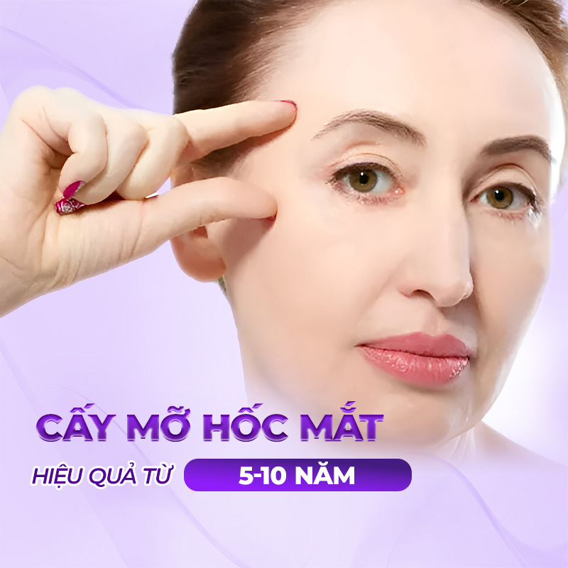 cấy mỡ hốc mắt giá mới nhất
