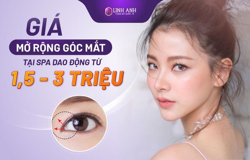 Chi phí mở rộng khóe mắt - Viện thẩm mỹ quốc tế Linh Anh Chi phí mở rộng khóe mắt - Viện thẩm mỹ quốc tế Linh Anh