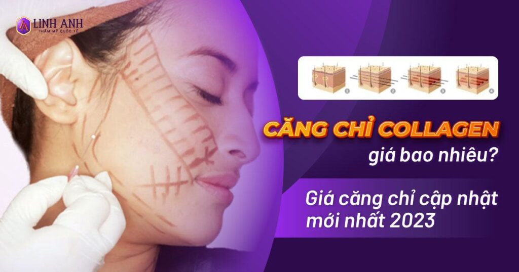 căng chỉ collagen giá bao nhiêu