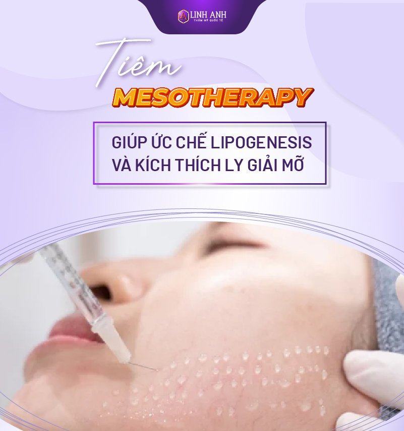 cấy mesotherapy