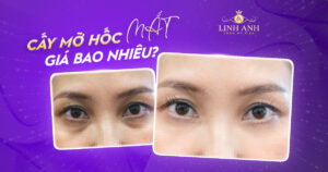cấy mỡ hốc mắt giá bao nhiêu