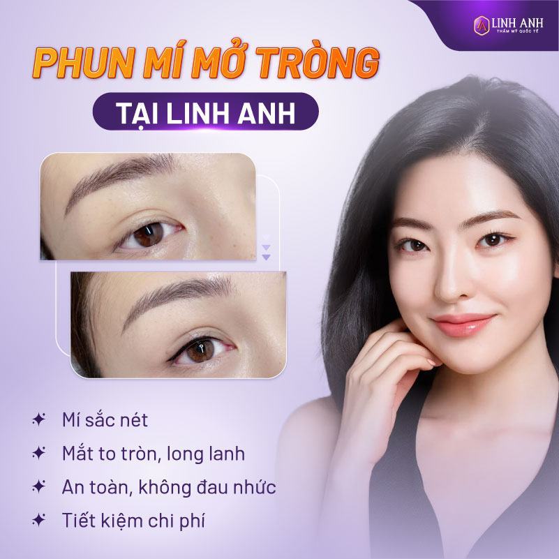 giá mở góc mắt - Viện thẩm mỹ quốc tế Linh Anh giá mở góc mắt - Viện thẩm mỹ quốc tế Linh Anh