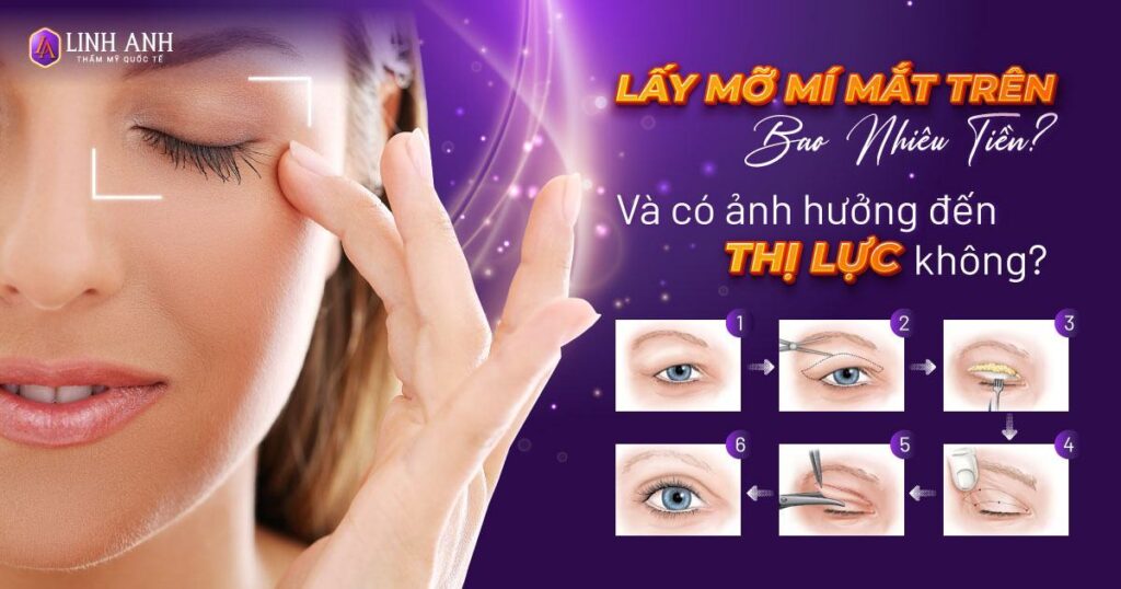 lấy mỡ mí mắt trên bao nhiêu tiền - Viện thẩm mỹ quốc tế Linh Anh