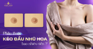 phẫu thuật kéo đầu nhũ hoa bao nhiêu tiền