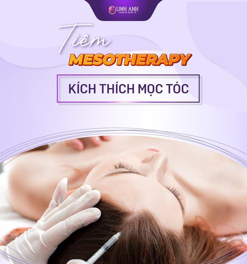phương pháp mesotherapy