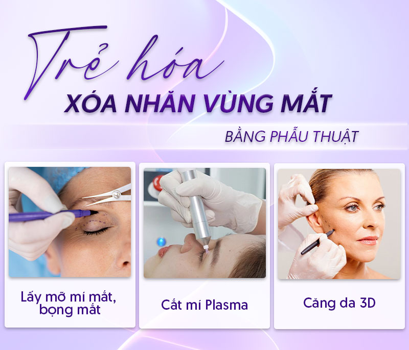 bảng giá xóa nhăn vùng mắt bảng giá xóa nhăn vùng mắt