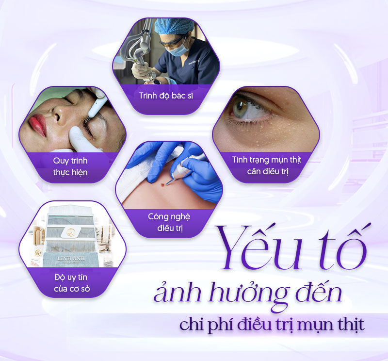 chi phí bắn mụn thịt chi phí bắn mụn thịt