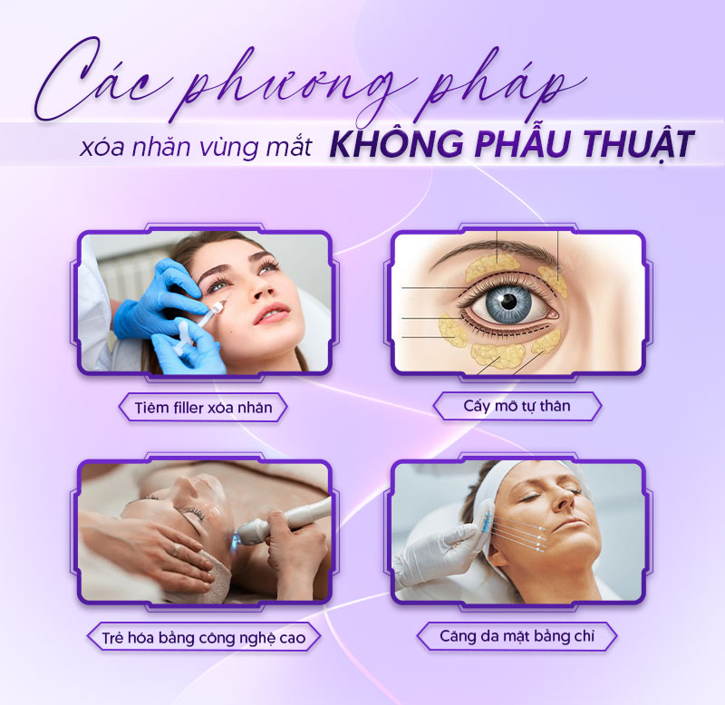 chi phí xóa nhăn vùng mắt chi phí xóa nhăn vùng mắt
