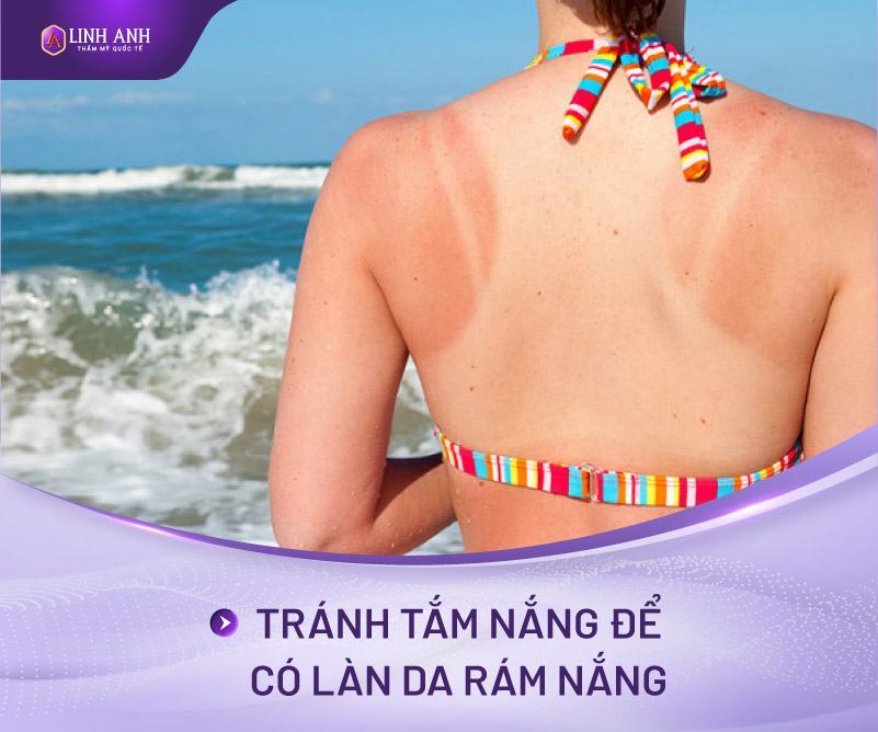 chống lão hóa da tuổi 30