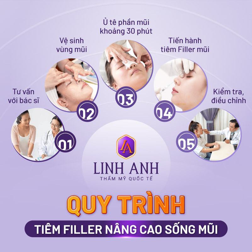 có nên tiêm filler mũi - Thẩm mỹ Quốc tế Linh Anh có nên tiêm filler mũi