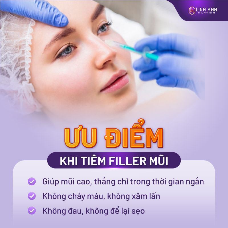 tiêm mũi filler - Thẩm mỹ Quốc tế Linh Anh giá tiêm filler mũi