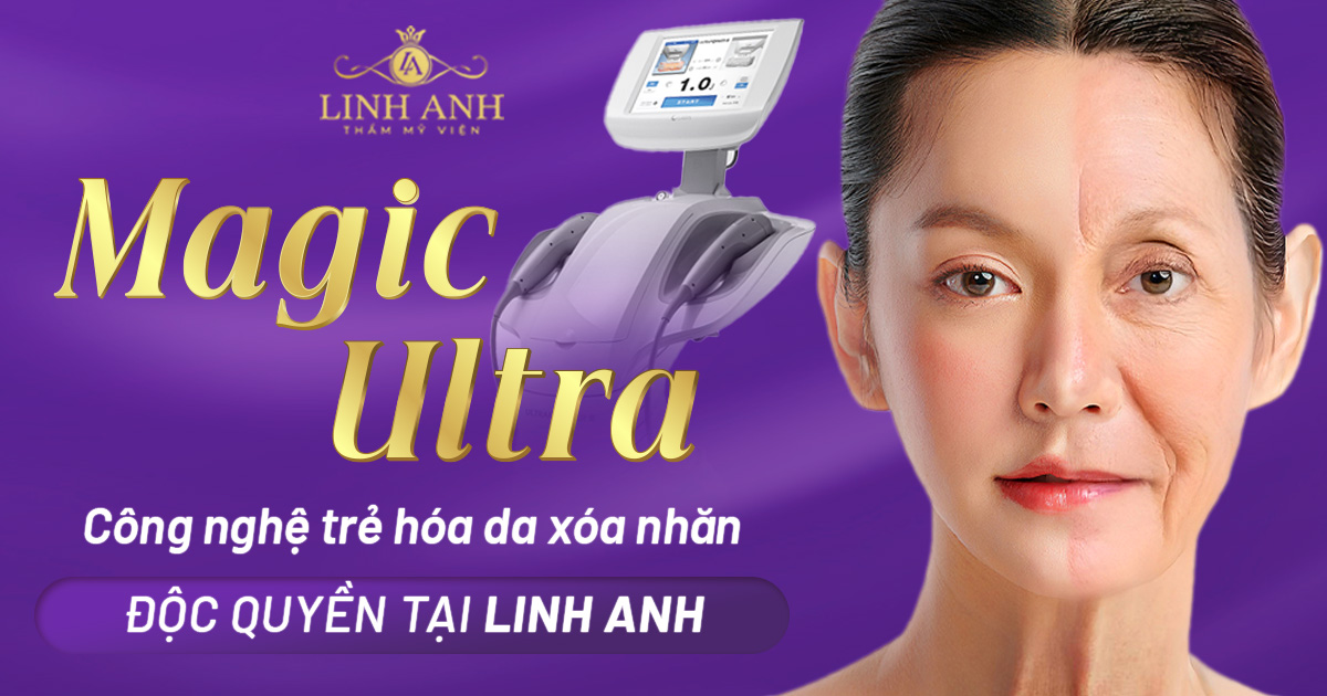 magic Ultra