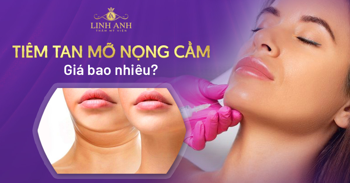 tiêm tan mỡ nọng cằm giá bao nhiêu