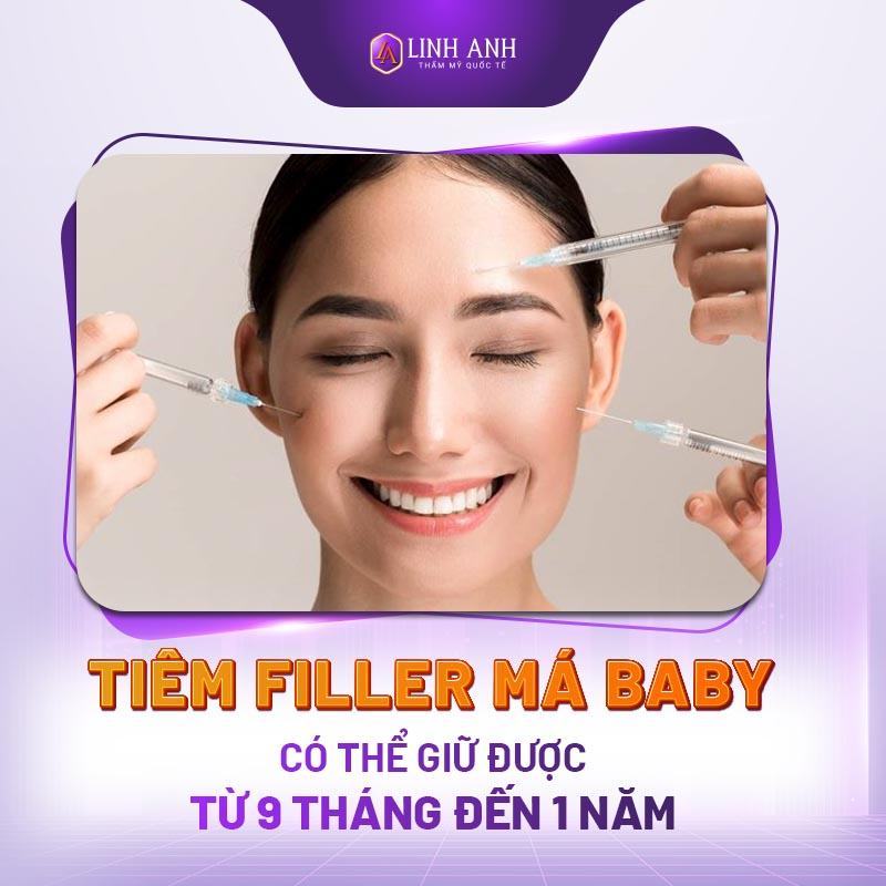 tiêm filler má baby - Thẩm mỹ Quốc tế Linh Anh bằng giá tiêm filler má baby