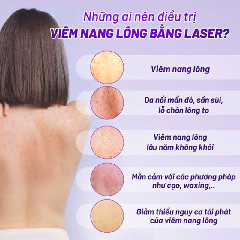 chi phí điều trị viêm nang long