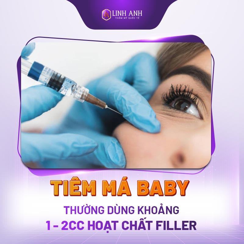 tiêm filler má - Thẩm mỹ Quốc tế Linh Anh có nên tiêm filler má baby