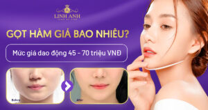 gọt hàm giá bao nhiêu