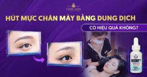 hút mực chân mày bằng dung dịch