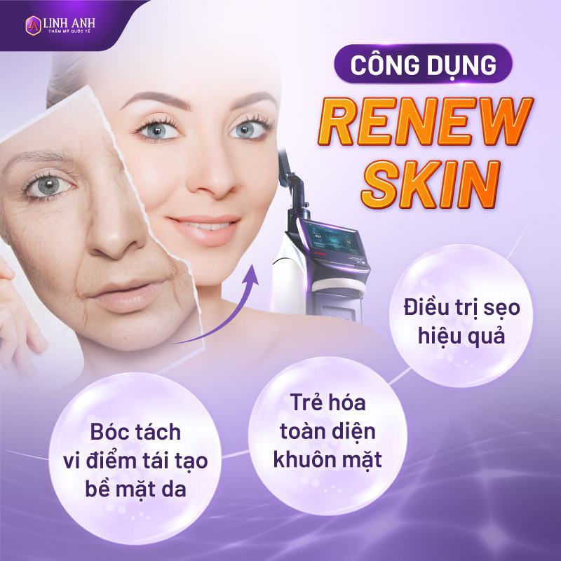 renew skin là gì
