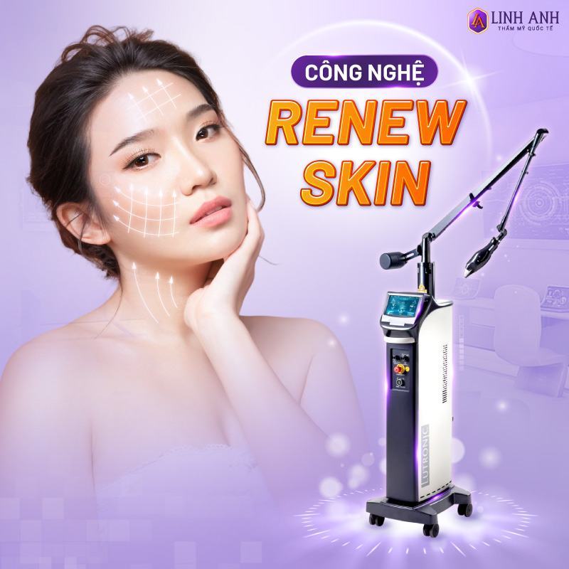 renew skin